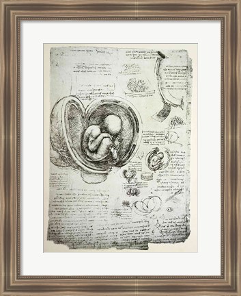 Framed Human Fetus in the Womb Print