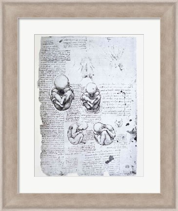 Framed Five Views of a Fetus in the Womb Print