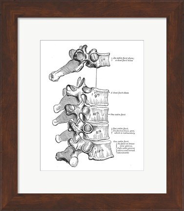 Framed Vertebrae Diagram Print